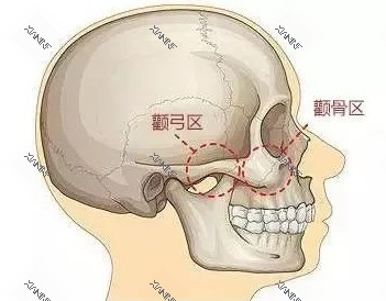颧骨部位图.jpg