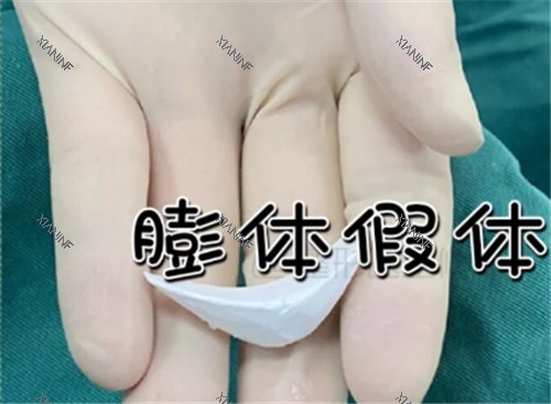 下巴假体.jpg 下巴假体.jpg