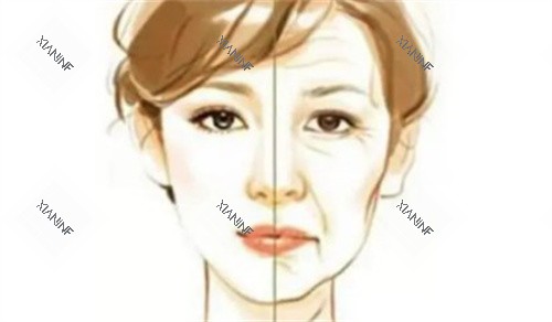 拉皮前后对比.jpg 拉皮前后对比.jpg