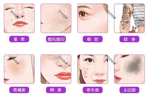 不同的皮肤斑点问题.jpg
