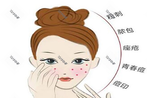 激光美肤适应症.jpg 激光美肤适应症.jpg