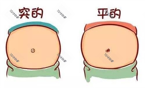 肚脐整形前后对比.jpg 肚脐整形前后对比.jpg