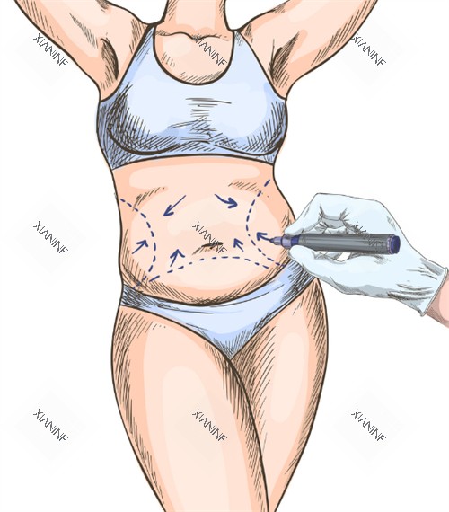 女生肚脐整形.jpg 女生肚脐整形.jpg
