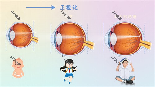 近视眼镜轴长与年龄变化示意图.jpg