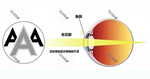 老花眼的眼睛.jpg