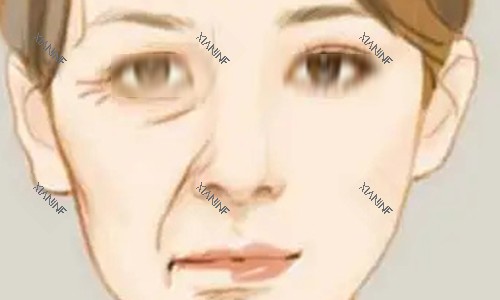 拉皮手术的对比动画图.jpg