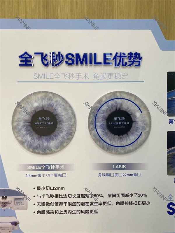全飞秒SMILE优势.jpg