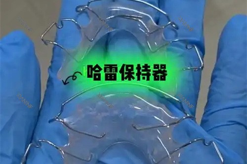 哈雷保持器.jpg