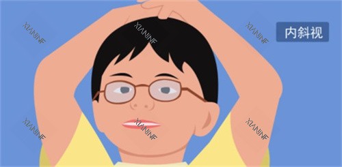 斜视动画图.jpg
