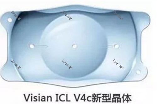近视眼手术材料.jpg