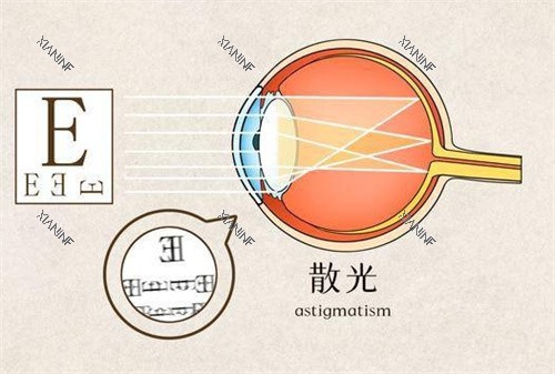 散光图片.jpg