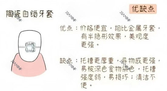 陶瓷自锁牙套.jpg