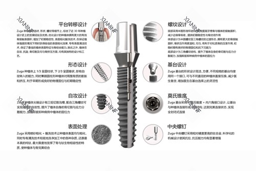 德国儒伽种植体优势特点图.jpg