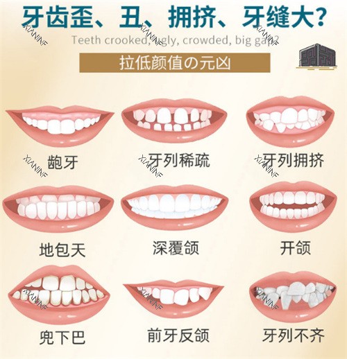 牙齿矫正适应症图示.jpg