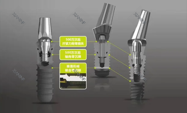 百康特种植牙怎么样.png