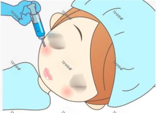 打针瘦脸手术过程图.png