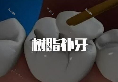 树脂补牙卡通.jpg