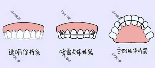 牙齿矫正正畸保持器漫画图.jpg