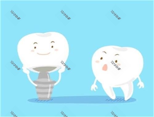 种植牙和健康牙对比图.jpg