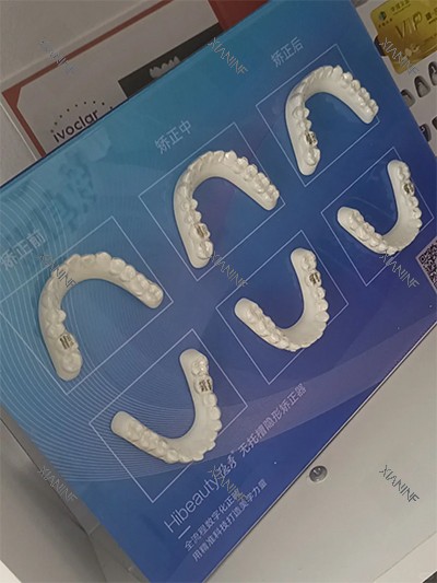 隐秀隐形牙齿矫正.jpg