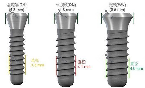 种植牙尺寸规格种类图.jpg