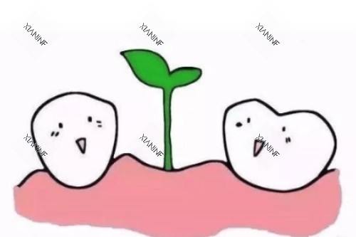 种植牙概念图.jpg