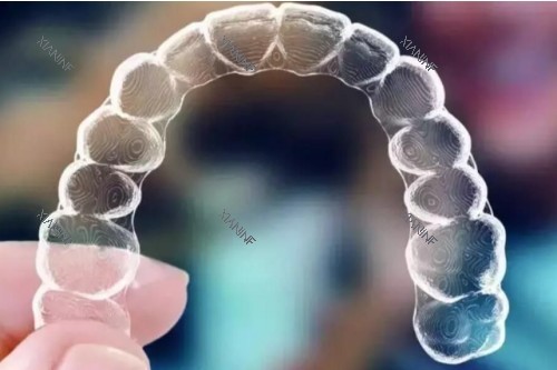 隐形矫正器模型图.jpg