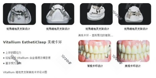 维他灵支架介绍示意图.jpg
