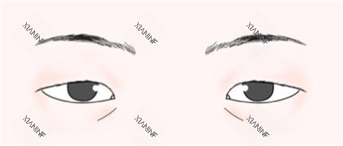 三角眼.jpg 三角眼.jpg