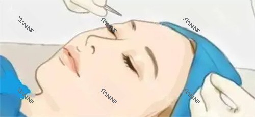 双眼皮手术过程卡通图.jpg 双眼皮手术过程卡通图.jpg