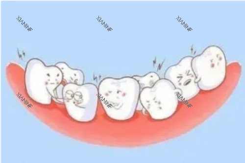 牙齿畸形卡通图.jpg