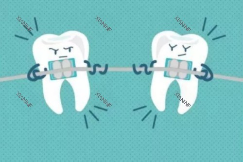 牙齿矫正卡通图.jpg