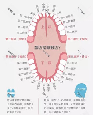智齿位置示意图.jpg