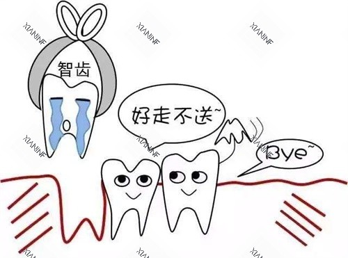 拔智齿示意图.jpg