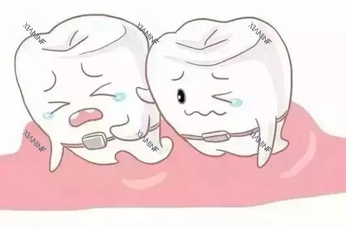 牙齿矫正卡通.jpg