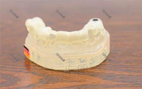 牙齿模具照片.jpg
