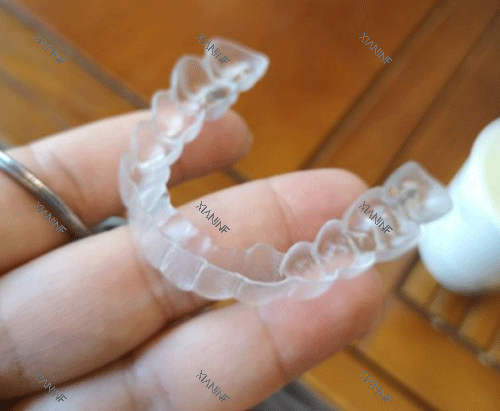 隐形牙齿矫正牙套图.png