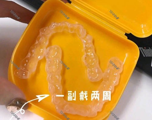 隐形牙套照片.jpg